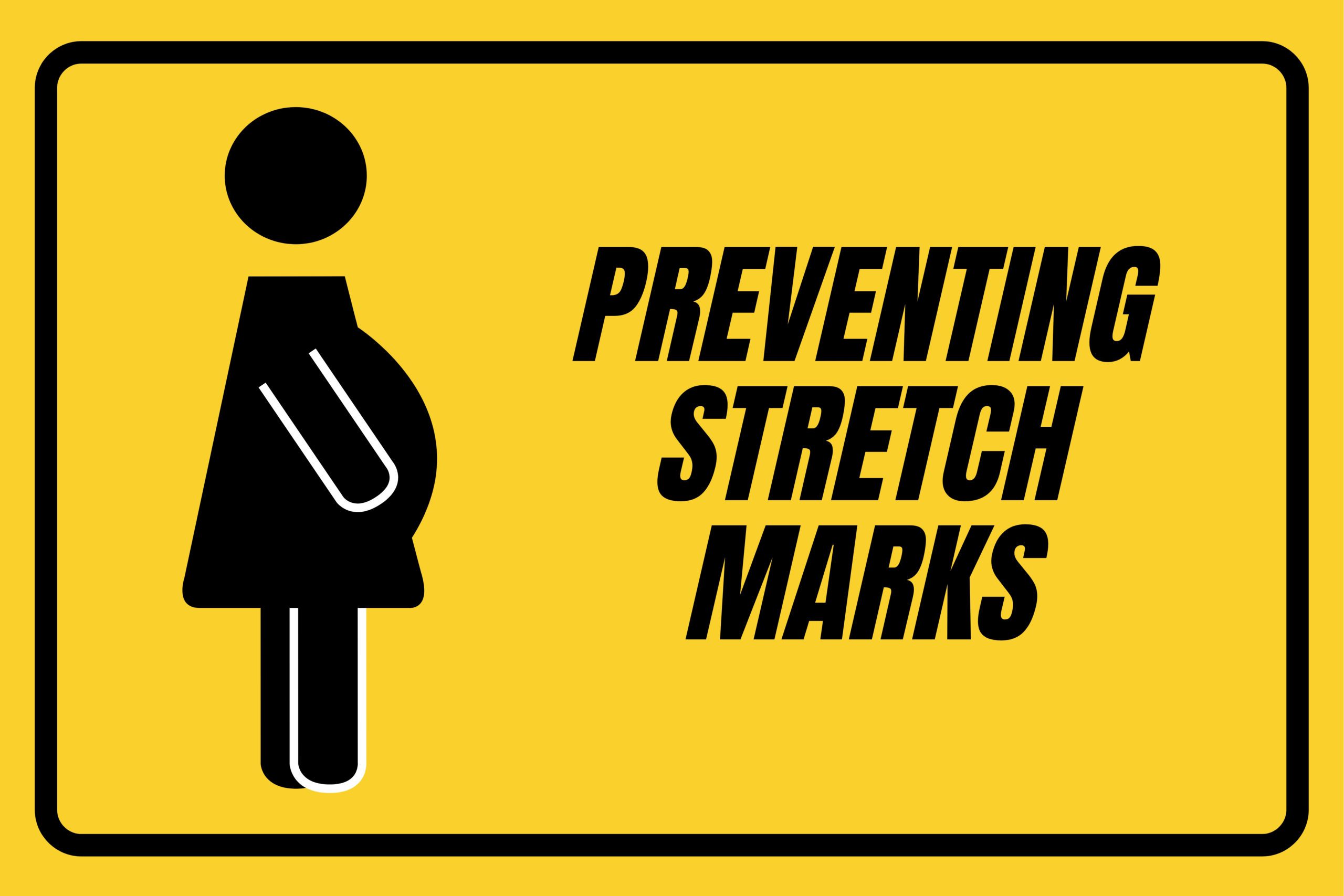 preventing-stretch-marks-pregnancy